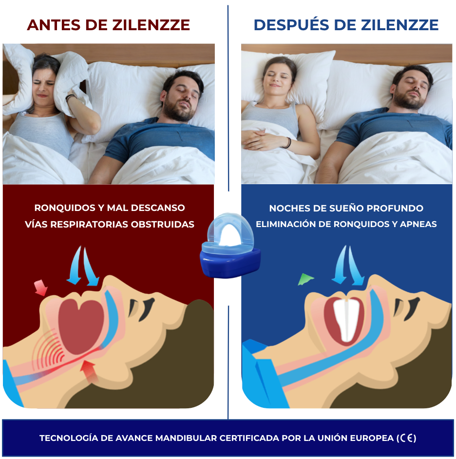 Férula Antirronquidos Zilenzze