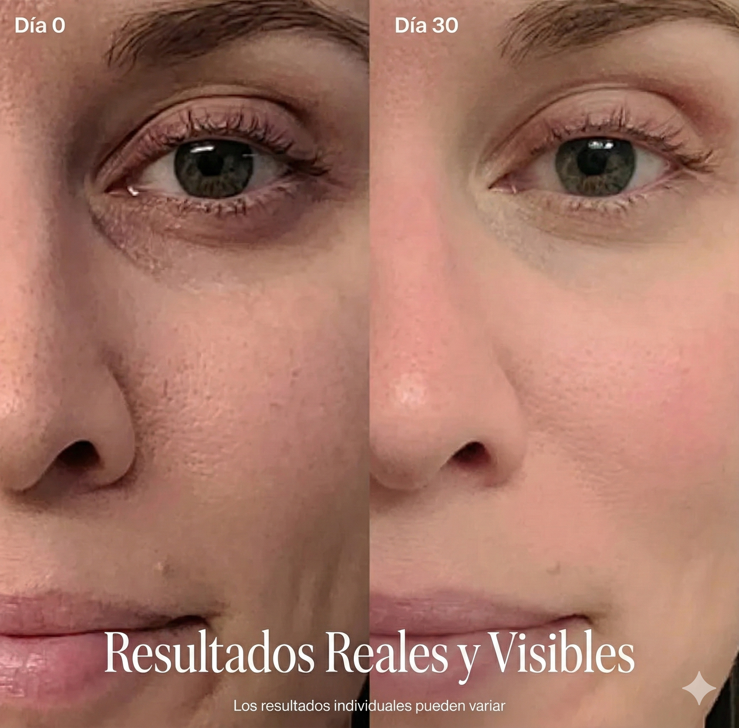 Varita Skincare Zilenwave - Renovación Facial Radiante 4 en 1 con Terapia de Luz Roja
