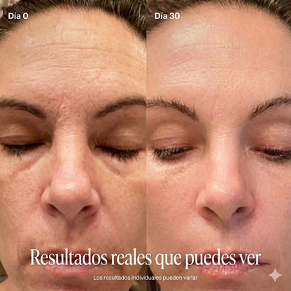 Varita Skincare Zilenwave - Renovación Facial Radiante 4 en 1 con Terapia de Luz Roja