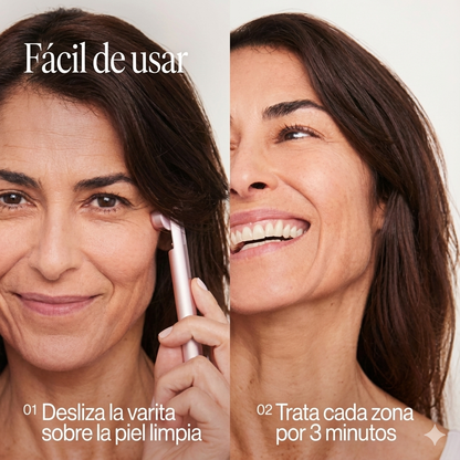 Varita Skincare Zilenwave - Renovación Facial Radiante 4 en 1 con Terapia de Luz Roja