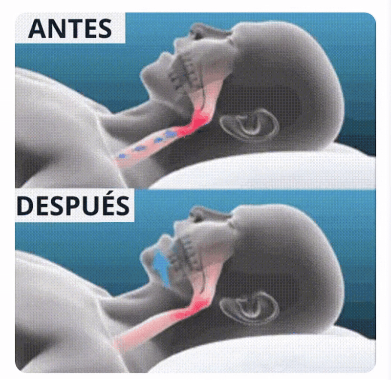 Férula Antirronquido Zilenzze